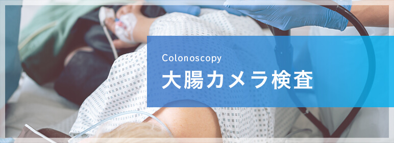 大腸カメラ検査